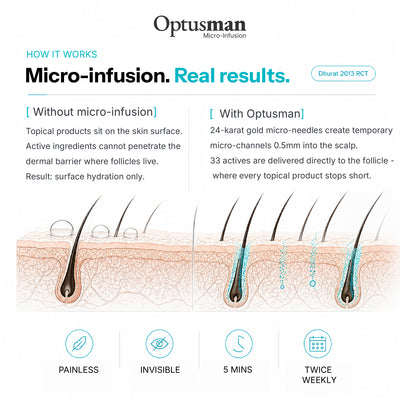 Optus™ Micro Infusion Hair Revival