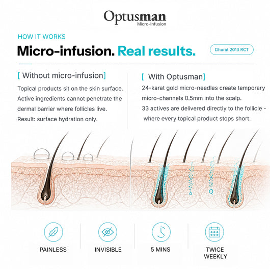 Optus™ Micro Infusion Hair Revival
