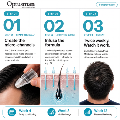 Optus™ Micro Infusion Hair Revival